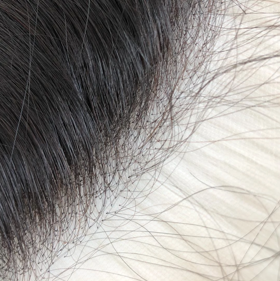 INVISILACE™ FRONTAL (STRAIGHT) - The Frontal Queen